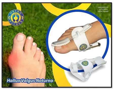 hallux